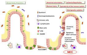 Physical examination an illustrated handbook. Cells Free Full Text Intestinal Stem Cell Development In The Neonatal Gut Pathways Regulating Development And Relevance To Necrotizing Enterocolitis Html
