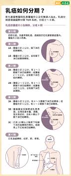 乳癌5症狀莫輕忽，乳房皮膚改變要小心分期、危險因子一次看- 癌症問康健