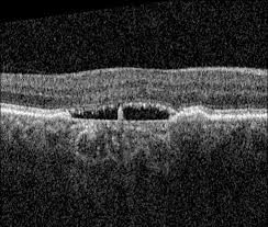 Image result for Pavetta cataractarum