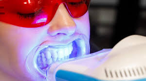 Image result for Teeth Whitening