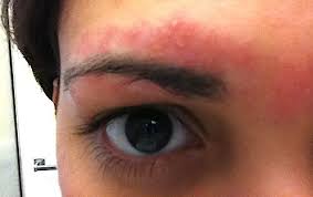 Before After Photos How To Prevent Eyebrow Waxing Red Irritated Bumps Best Products Treatments To Soothe Beautystat Com Waxed Eyebrows Wax Eyebrows At Home Face Wax