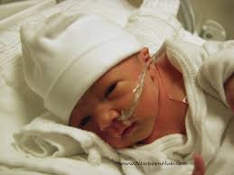 Preemie Baby