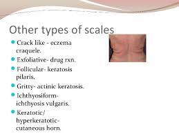 Skin Lesions