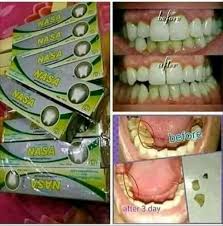 Pasta Gigi Odol Nasa Dan Menyembuhkan Sakit Gigi Ringan Lazada Indonesia