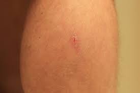 Pin On Skin Care