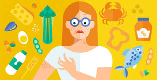 An autotroph is an organism that can make its own food for energy. Food Allergy Symptoms