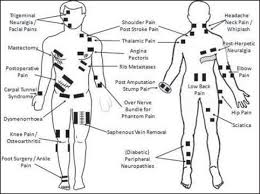 Tens Unit Electrode Placement For Si Joint Pain Medical Info