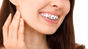 Are Braces Worth The Cost? - Viva Smiles | Family & Kids Orthodontist |  Garden Grove Orthodontist