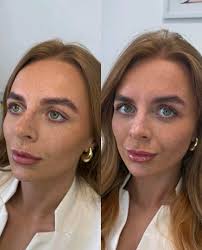 Aesthetics By Olivia