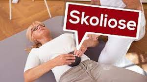 Bei skoliose ist flexible & drucklose lagerung der wirbelsäule ideal ▷ das einzige schlafsystem, das vom deutschen skoliose netzwerk unterstützt wird! Welche Matratze Ist Bei Skoliose Zu Empfehlen