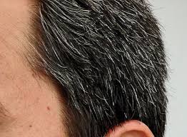 I wanna know how i get the white hair option because i really want white hair. How To Get Rid Of White Hair Naturally Permanently On Beard Face Home Remedies For White Hair