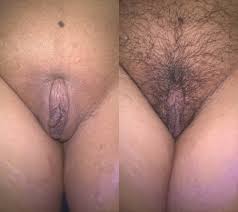 JoyTwoSex - Growing Hair (4 Weeks) Porn Pictures, XXX Photos, Sex Images  4037207 - PICTOA