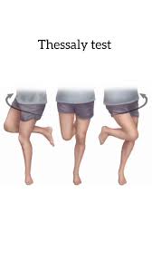 Image result for Thessaly Test