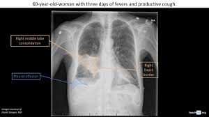 Image result for Silhouette Sign