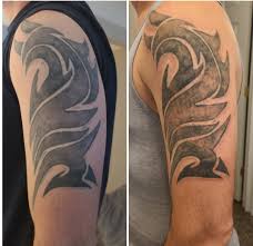 Or maybe you just want to fade your tattoo for a cover up. Results Immediately After First Session With Picosure Laser Tattoo Removal Tattooremoval