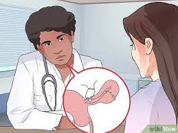 Many women finding out that a tubal reversal surgery is the most cost effective treatment to get pregnant after a tubal ligation. How To Get Tied Tubes Untied 15 Steps With Pictures Wikihow