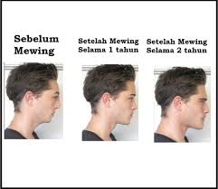 Mewing Bisa Membuat Lebih Cantik Dan Ganteng Frolic With Insight