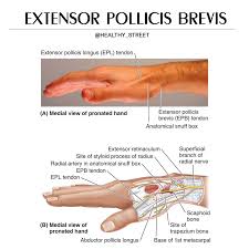 We did not find results for: Healthy Street Extensor Pollicis Brevis Anatomical Facebook