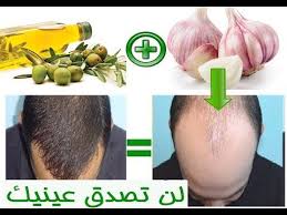 علاج تساقط الشعر بالثوم وزيت الزيتون لن تصدق نفسك إدا جربتها youtube