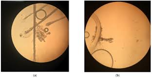 Image result for Demodex brevis