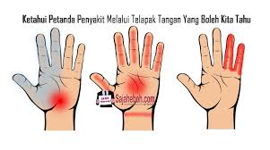 Ketahui Petanda Penyakit Melalui Telapak Tangan Yang Boleh Kita Tahu