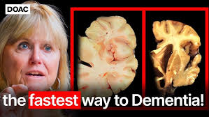 Art releases the subconscious trauma