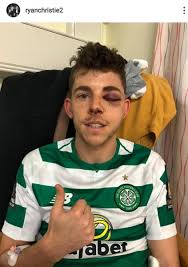 Born june 11, 2001 in ardrossan, scotland) is a scottish footballer. Celtic Ace Ryan Christie Reveals Gruesome Injury In Funny Instagram Post The Scotsman