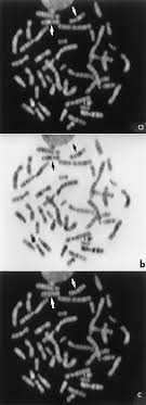 How can we use genetics to study human inheritance?chapter summary karyotypes 14.1 human transmission of human traits chromosomes human pedigrees from molecule to phenotype 14.2 human genetic disorders chromosomal disorders 14.3 studying the manipulating dna human genome the human genome project 1. Fish Localization Of The Nab2 Gene To Human Chromosomes A Digital Download Scientific Diagram