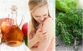 Como Curar El Prurito Cutaneo 6 Remedios Naturales Mejor Con Salud