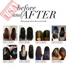 Biotin is a b vitamin (vitamin b7, specifically) that's an essential bodily nutrient. Imported Hairtamin Fast Hair Growth Biotin Vitamins Gluten Free Thirty Vegetarian Capsules Sale In Pakistan