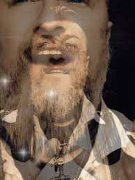 Karl Jeroboan Dsds Bruises