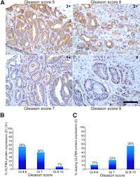 Deletion Of The Olfactomedin 4 Gene Is Associated With