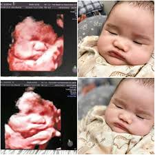 The Baby Ultrasound at Robinsons Place Manila