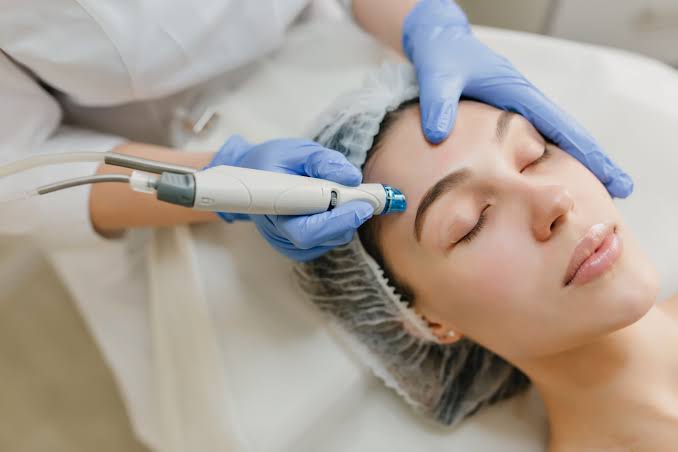 Mesotherapy Treatment in Dubai - Mesotherapy for Skin & Face
