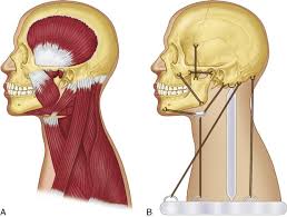 Maybe you would like to learn more about one of these? 2 Functional Neuroanatomy And Physiology Of The Masticatory System Pocket Dentistry