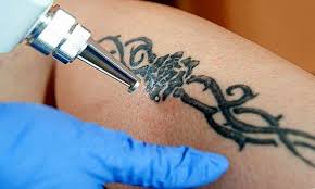 Dövme tattoo makinesi 10 warp tamamı el yapımı özel bilyalı tasarım. Kalici Dovme Nasil Kaldirilir Anne Ve Cocuk Sagligi Tombul Bebek