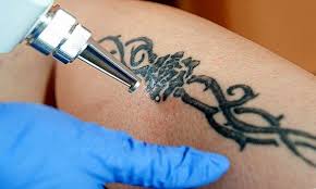 Dövme tattoo piercing dövmeci taner bakırköy Kalici Dovme Nasil Kaldirilir Anne Ve Cocuk Sagligi Tombul Bebek