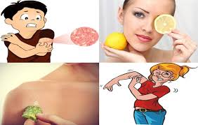 The above remedies will undoubtedly work well in relieving itchy skin. Eight Home Remedies For Itchy Skin Inminutes Magazine