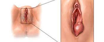 Ayuda Bartolinitis Y O Varices Vulvares Club De Bebes Noviembre 2018 Babycenter