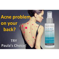 Paula S Choice Clear Acne Body Spray With 2 Salicylic Acid Shopee Malaysia