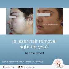 Ipl hair removal spot removal acne removal beauty equipment supplier. Laser Hair Removal Is A Permanent And An Effective Way Of Hair Removal For Further Queries Book An Appointment Wi Botox Injections Skin Blemishes Hair Removal