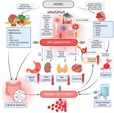 Image result for Anemia