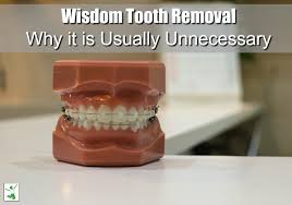 Why Most Wisdom Tooth Removal Is Unnecessary Healthy Home Economist