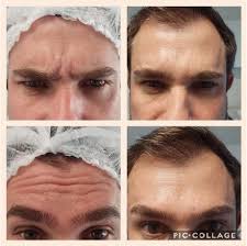 Grátis: Corrente Aussie: Eletroterapia Estética