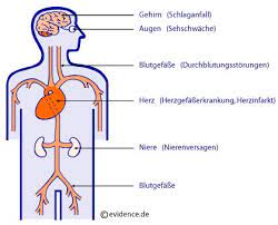 Bluthochdruck Ursachen Causes Symptoms Treatment Bluthochdruck Ursachen