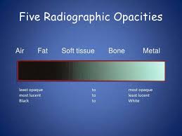 Radiographic Opacities Dental Hygiene Graduation Dental Hygiene School Dental Exam