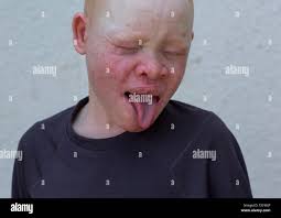 Braccio destro sopra immagini e fotografie stock ad alta risoluzione