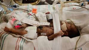 Fundraiser by Moni Salcido : Fighting NEC with Benjamin