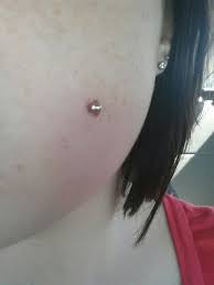 Pin On Healing Cheek Piercings