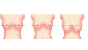 ما الفرق بين ثدي العزباء والمتزوجة موقع زيادة